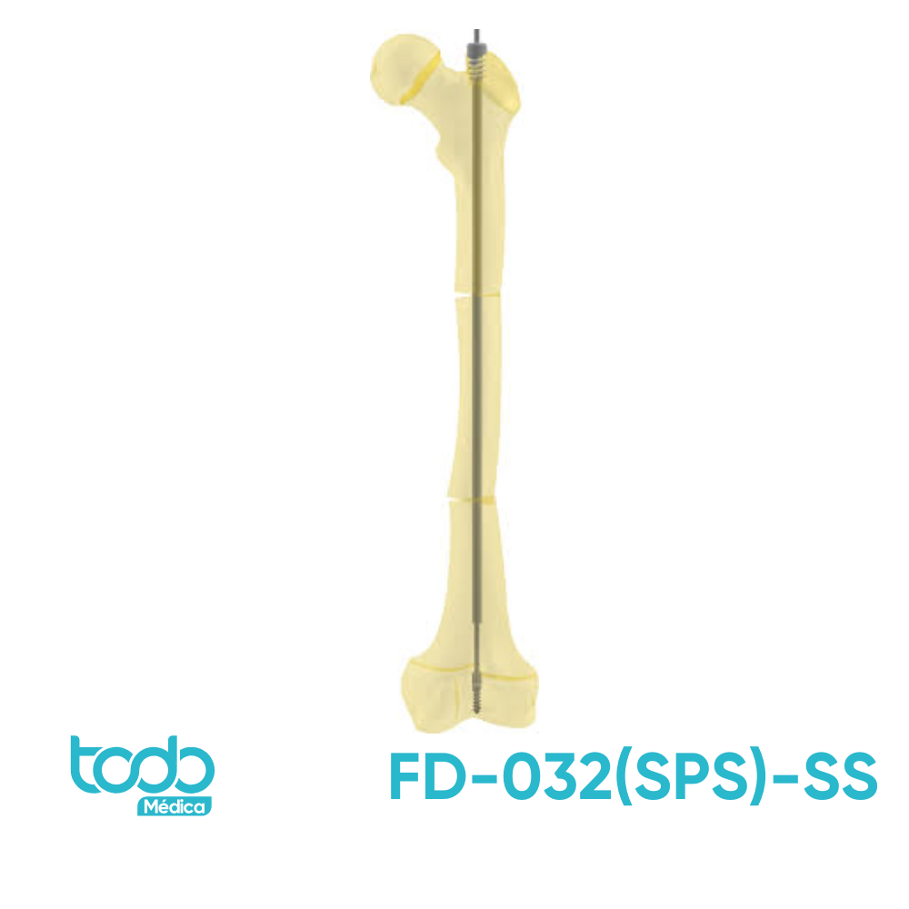Clavo Telescópico PEGA Medical Tibia/Húmero Rosca Corta 3.2x197